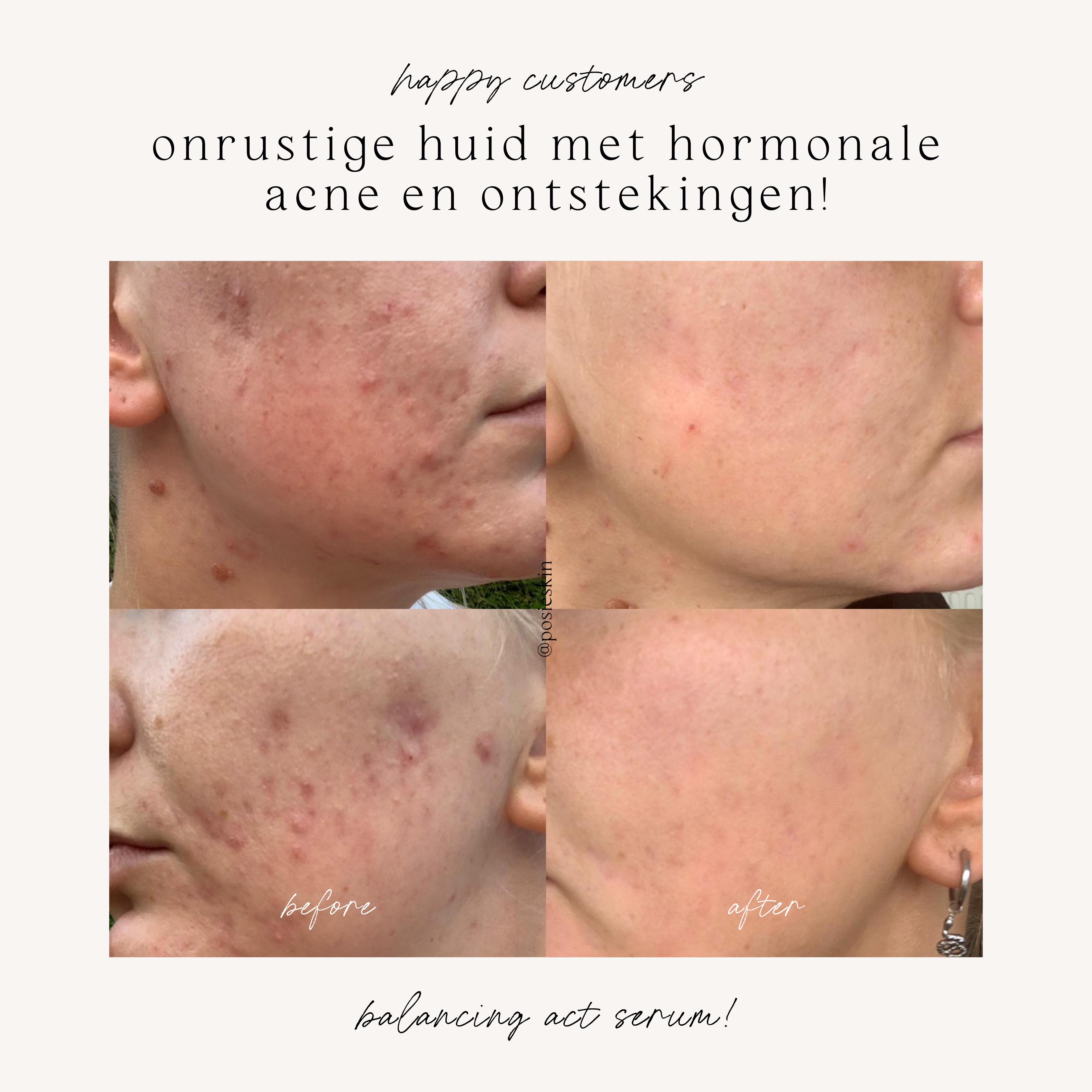 Balancing Act Serum - Posie
